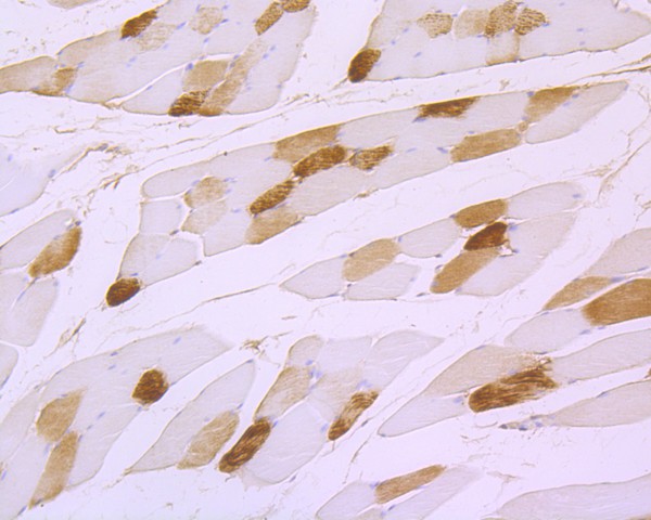 Immunohistochemical analysis of paraffin-embedded rat skeletal muscle tissue using anti-Myoglobin antibody. The section was pre-treated using heat mediated antigen retrieval with Tris-EDTA buffer (pH 8.0-8.4) for 20 minutes.The tissues were blocked in 5% BSA for 30 minutes at room temperature, washed with ddH2O and PBS, and then probed with the primary antibody (ET1610-56, 1/200) for 30 minutes at room temperature. The detection was performed using an HRP conjugated compact polymer system. DAB was used as the chromogen. Tissues were counterstained with hematoxylin and mounted with DPX.