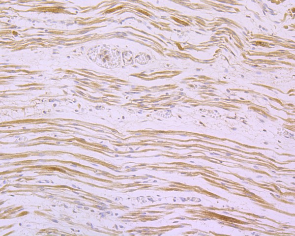 Immunohistochemical analysis of paraffin-embedded human fetal skeletal muscle tissue using anti-Myoglobin antibody. The section was pre-treated using heat mediated antigen retrieval with Tris-EDTA buffer (pH 8.0-8.4) for 20 minutes.The tissues were blocked in 5% BSA for 30 minutes at room temperature, washed with ddH2O and PBS, and then probed with the primary antibody (ET1610-56, 1/50) for 30 minutes at room temperature. The detection was performed using an HRP conjugated compact polymer system. DAB was used as the chromogen. Tissues were counterstained with hematoxylin and mounted with DPX.