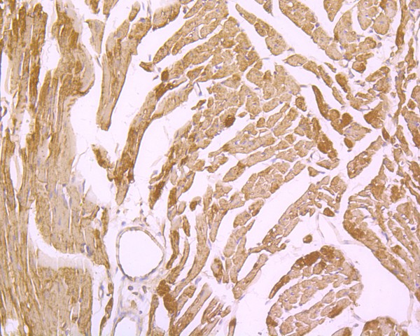 Immunohistochemical analysis of paraffin-embedded mouse heart tissue using anti-Myoglobin antibody. The section was pre-treated using heat mediated antigen retrieval with Tris-EDTA buffer (pH 8.0-8.4) for 20 minutes.The tissues were blocked in 5% BSA for 30 minutes at room temperature, washed with ddH2O and PBS, and then probed with the primary antibody (ET1610-56, 1/50) for 30 minutes at room temperature. The detection was performed using an HRP conjugated compact polymer system. DAB was used as the chromogen. Tissues were counterstained with hematoxylin and mounted with DPX.