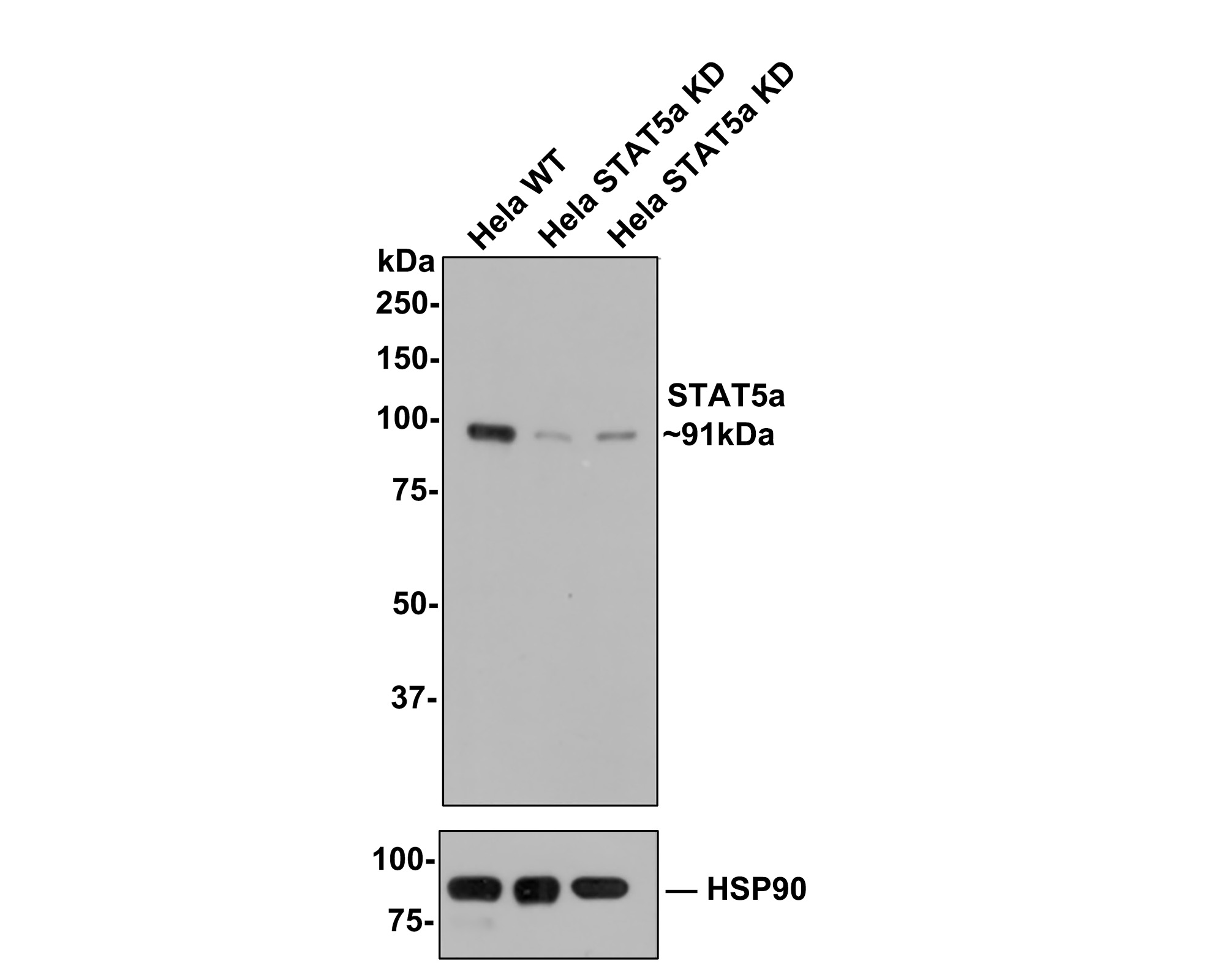 All lanes: Western blot analysis of STAT5a with anti-STAT5a antibody (ET1610-58) at 1/500 dilution.<br />
<br />
Lane 1: Wild-type Hela whole cell lysate.<br />
Lane 2/3: STAT5a knockdown Hela whole cell lysate.<br />
<br />
ET1610-58 was shown to specifically react with STAT5a in Wild-type Hela cells. Weakened bands were observed when STAT5a knockdown samples were tested. Wild-type and STAT5a knockdown samples were subjected to SDS-PAGE. Proteins were transferred to a PVDF membrane and blocked with 5% NFDM in TBST for 1 hour at room temperature. The primary Anti-STAT5a antibody (ET1610-58, 1/500) and Anti-HSP90 antibody (ET1605-56, 1/10,000) were used in 5% BSA at room temperature for 2 hours. Goat Anti-Rabbit IgG H&L (HRP) Secondary Antibody (HA1001) at 1:300,000 dilution was used for 1 hour at room temperature.
