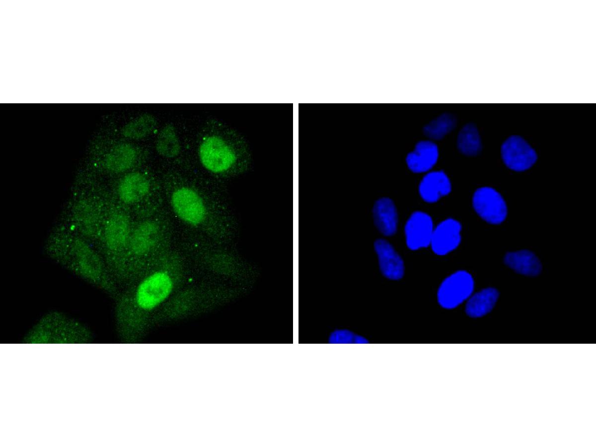 ICC staining of STAT5a in C2C12 cells (green). Formalin fixed cells were permeabilized with 0.1% Triton X-100 in TBS for 10 minutes at room temperature and blocked with 1% Blocker BSA for 15 minutes at room temperature. Cells were probed with the primary antibody (ET1610-58, 1/50) for 1 hour at room temperature, washed with PBS. Alexa Fluor®488 Goat anti-Rabbit IgG was used as the secondary antibody at 1/1,000 dilution. The nuclear counter stain is DAPI (blue).