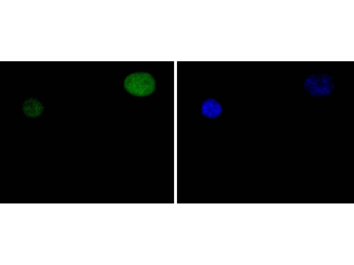 ICC staining of STAT5a in C2C12 cells (green). Formalin fixed cells were permeabilized with 0.1% Triton X-100 in TBS for 10 minutes at room temperature and blocked with 1% Blocker BSA for 15 minutes at room temperature. Cells were probed with the primary antibody (ET1610-58, 1/50) for 1 hour at room temperature, washed with PBS. Alexa Fluor®488 Goat anti-Rabbit IgG was used as the secondary antibody at 1/1,000 dilution. The nuclear counter stain is DAPI (blue).