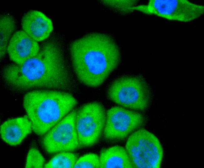 ICC staining of CD13 in AGS cells (green). Formalin fixed cells were permeabilized with 0.1% Triton X-100 in TBS for 10 minutes at room temperature and blocked with 1% Blocker BSA for 15 minutes at room temperature. Cells were probed with the primary antibody (ET1610-59, 1/50) for 1 hour at room temperature, washed with PBS. Alexa Fluor®488 Goat anti-Rabbit IgG was used as the secondary antibody at 1/1,000 dilution. The nuclear counter stain is DAPI (blue).