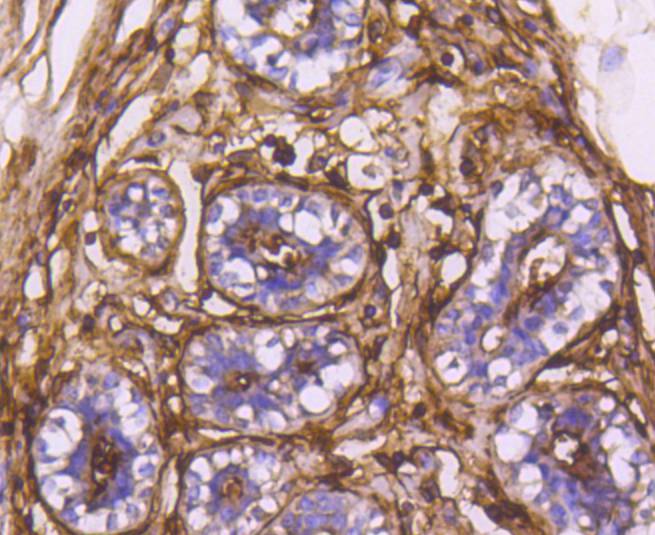 Immunohistochemical analysis of paraffin-embedded human breast tissue using anti-CD13 antibody. The section was pre-treated using heat mediated antigen retrieval with Tris-EDTA buffer (pH 8.0-8.4) for 20 minutes.The tissues were blocked in 5% BSA for 30 minutes at room temperature, washed with ddH2O and PBS, and then probed with the primary antibody (ET1610-59, 1/50) for 30 minutes at room temperature. The detection was performed using an HRP conjugated compact polymer system. DAB was used as the chromogen. Tissues were counterstained with hematoxylin and mounted with DPX.