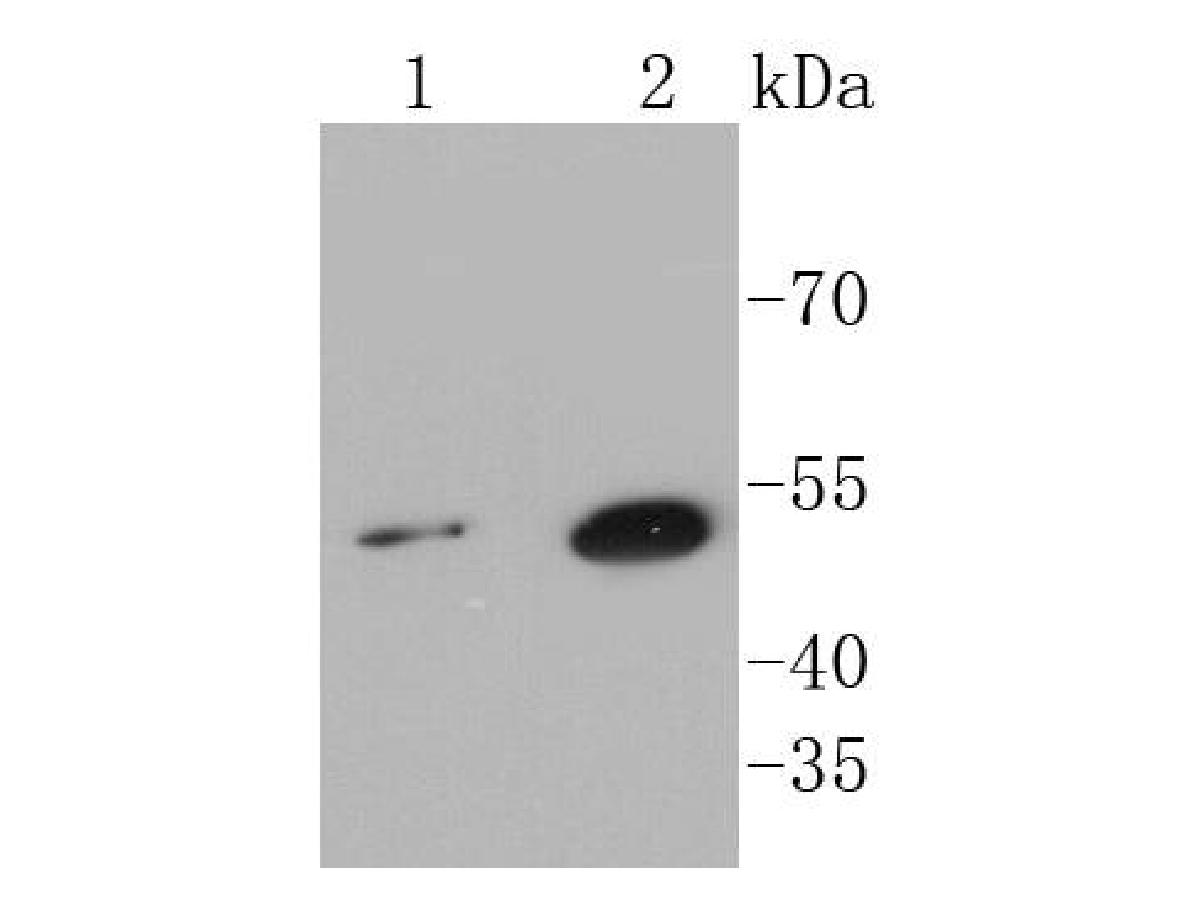 Western blot analysis of Sonic Hedgehog Protein on different lysates using anti-Sonic Hedgehog Protein antibody at 1/1,000 dilution.<br />
Positive control:   <br />
Lane 1: Hela               <br />
Lane 2: HepG2