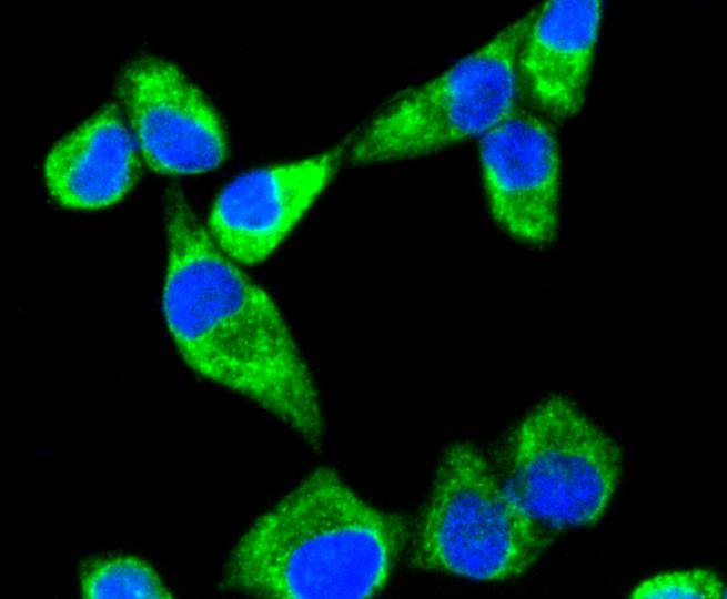 ICC staining Sonic Hedgehog Protein in Hela cells (green). The nuclear counter stain is DAPI (blue). Cells were fixed in paraformaldehyde, permeabilised with 0.25% Triton X100/PBS.