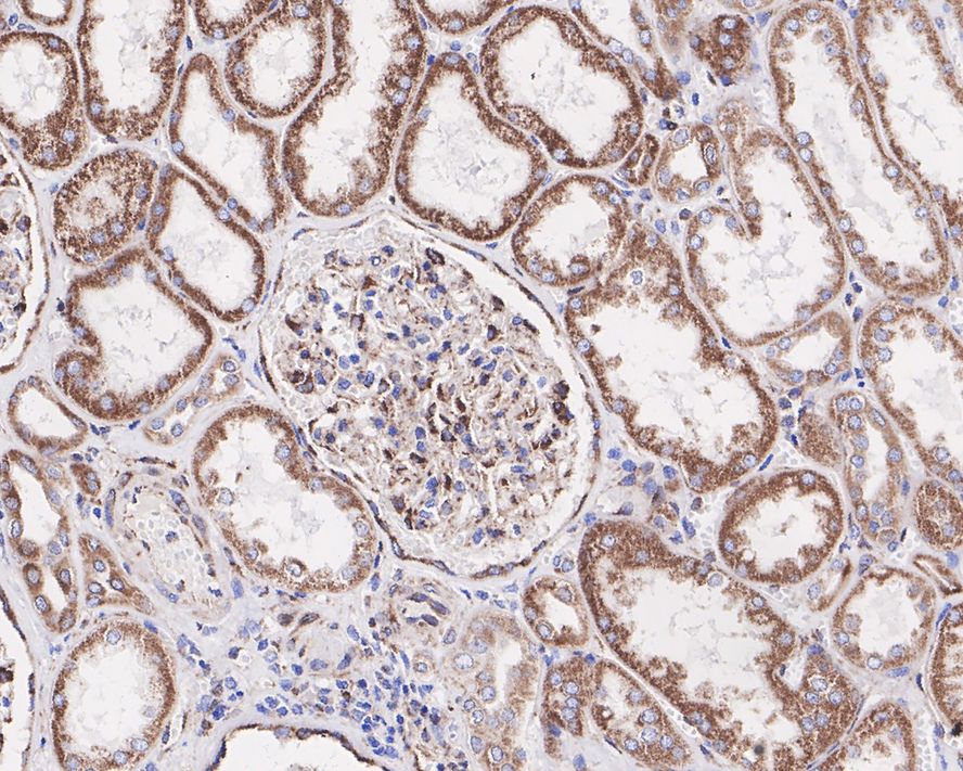 Immunohistochemical analysis of paraffin-embedded human kidney tissue using anti-Sonic Hedgehog Protein antibody. Counter stained with hematoxylin.