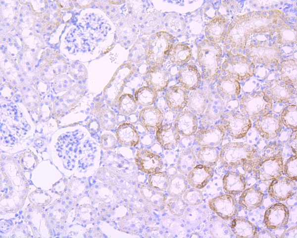 Immunohistochemical analysis of paraffin-embedded rat kidney tissue using anti-Sonic Hedgehog Protein antibody. Counter stained with hematoxylin.