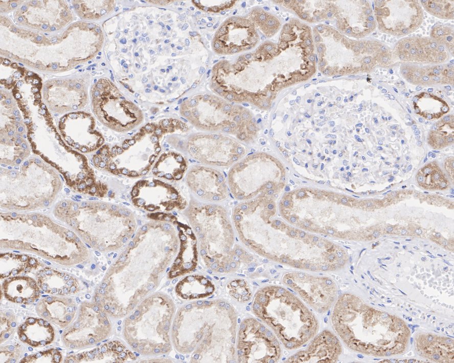 Immunohistochemical analysis of paraffin-embedded human kidney tissue with Rabbit anti-Cytochrome C antibody (ET1610-60) at 1/1,000 dilution.<br />
<br />
The section was pre-treated using heat mediated antigen retrieval with Tris-EDTA buffer (pH 9.0) for 20 minutes. The tissues were blocked in 1% BSA for 20 minutes at room temperature, washed with ddH2O and PBS, and then probed with the primary antibody (ET1610-60) at 1/1,000 dilution for 1 hour at room temperature. The detection was performed using an HRP conjugated compact polymer system. DAB was used as the chromogen. Tissues were counterstained with hematoxylin and mounted with DPX.