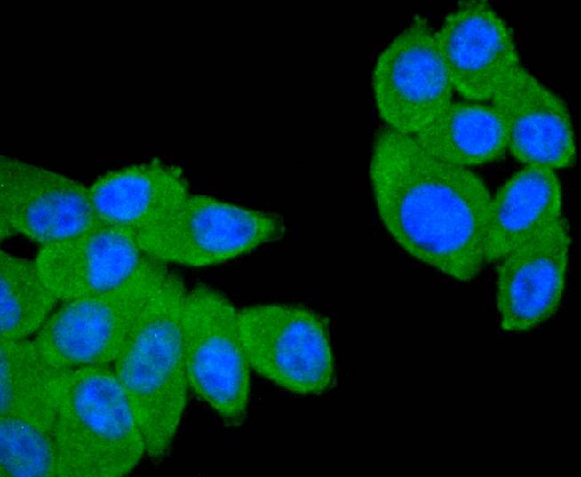 ICC staining of CD21 in HepG2 cells (green). Formalin fixed cells were permeabilized with 0.1% Triton X-100 in TBS for 10 minutes at room temperature and blocked with 1% Blocker BSA for 15 minutes at room temperature. Cells were probed with the primary antibody (ET1610-61, 1/50) for 1 hour at room temperature, washed with PBS. Alexa Fluor®488 Goat anti-Rabbit IgG was used as the secondary antibody at 1/1,000 dilution. The nuclear counter stain is DAPI (blue).