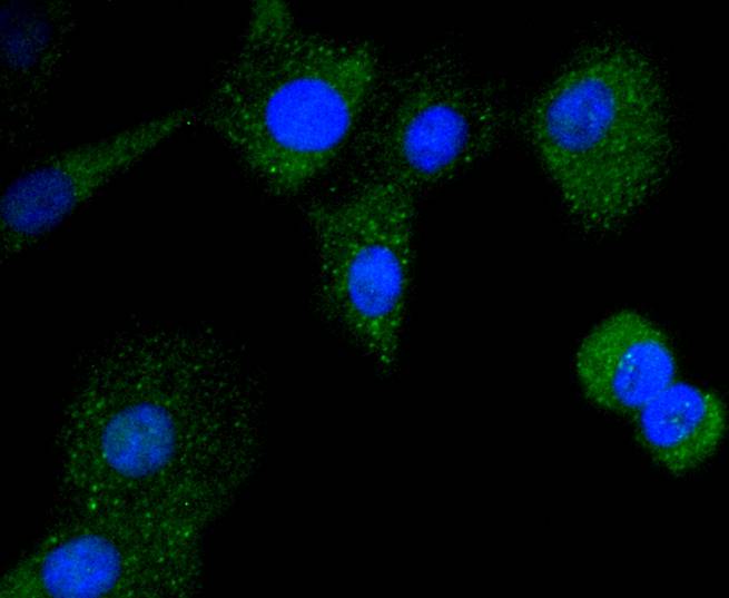 ICC staining of CD21 in A549 cells (green). Formalin fixed cells were permeabilized with 0.1% Triton X-100 in TBS for 10 minutes at room temperature and blocked with 1% Blocker BSA for 15 minutes at room temperature. Cells were probed with the primary antibody (ET1610-61, 1/50) for 1 hour at room temperature, washed with PBS. Alexa Fluor®488 Goat anti-Rabbit IgG was used as the secondary antibody at 1/1,000 dilution. The nuclear counter stain is DAPI (blue).
