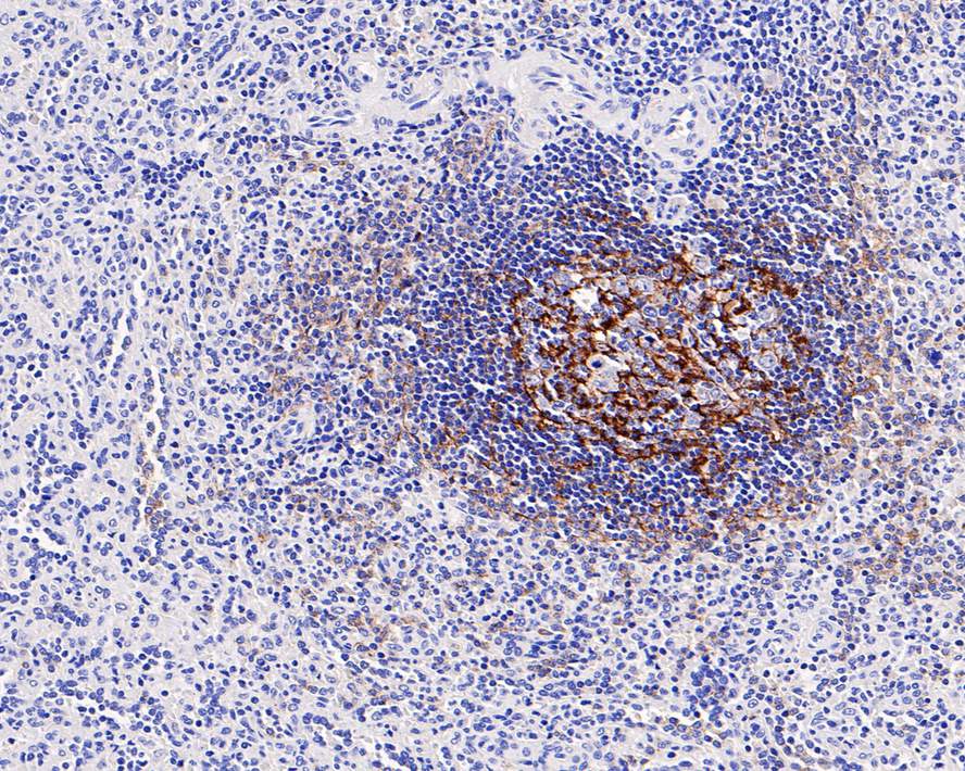 Immunohistochemical analysis of paraffin-embedded human spleen tissue with Rabbit anti-CD21 antibody (ET1610-61) at 1/800 dilution.<br />
<br />
The section was pre-treated using heat mediated antigen retrieval with Tris-EDTA buffer (pH 9.0) for 20 minutes. The tissues were blocked in 1% BSA for 20 minutes at room temperature, washed with ddH2O and PBS, and then probed with the primary antibody (ET1610-61) at 1/800 dilution for 1 hour at room temperature. The detection was performed using an HRP conjugated compact polymer system. DAB was used as the chromogen. Tissues were counterstained with hematoxylin and mounted with DPX.