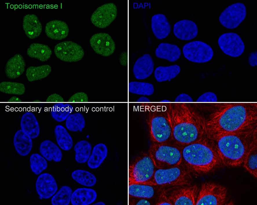 ICC staining of Topoisomerase I in Hela cells (green). Formalin fixed cells were permeabilized with 0.1% Triton X-100 in TBS for 10 minutes at room temperature and blocked with 1% Blocker BSA for 15 minutes at room temperature. Cells were probed with the primary antibody (ET1610-62, 1/50) for 1 hour at room temperature, washed with PBS. Alexa Fluor®488 Goat anti-Rabbit IgG was used as the secondary antibody at 1/1,000 dilution. The nuclear counter stain is DAPI (blue).