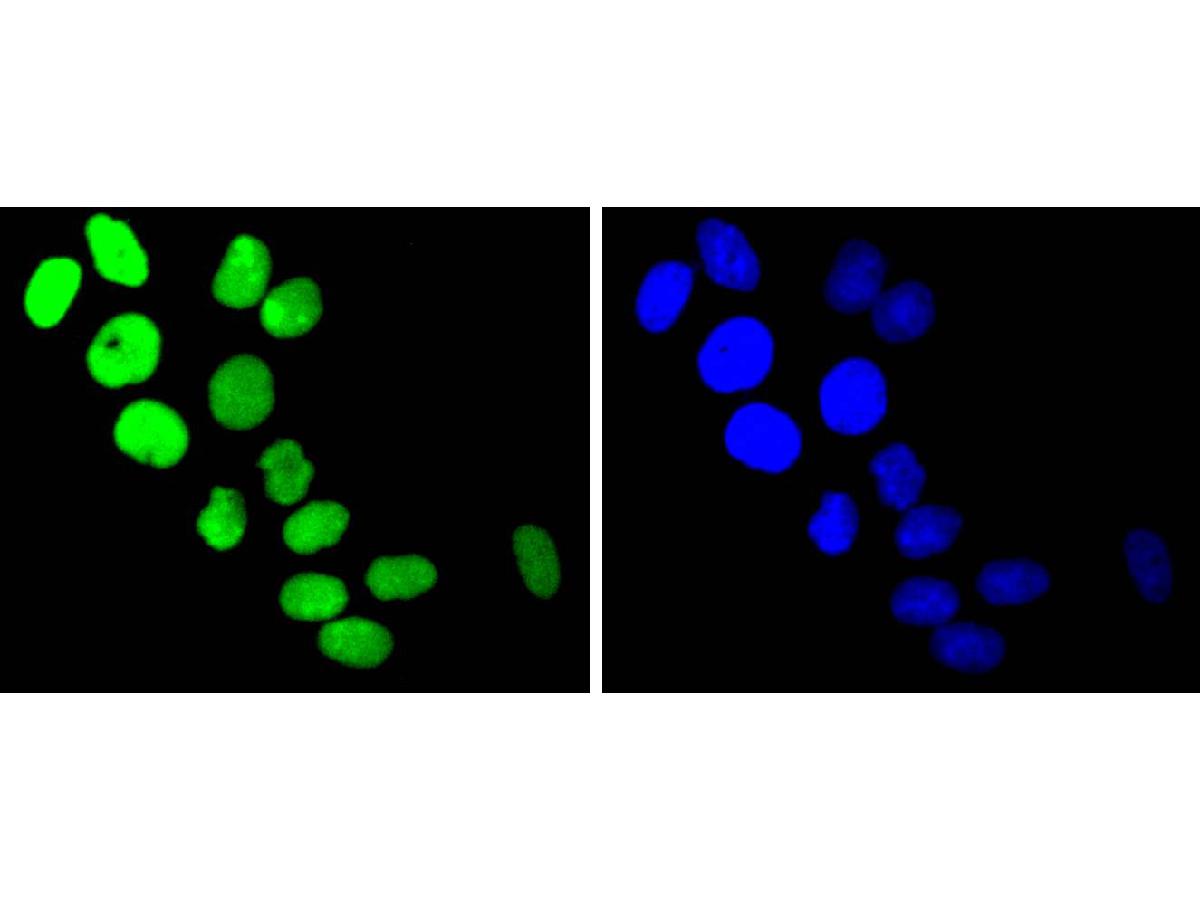 ICC staining of Topoisomerase I in SHG-44 cells (green). Formalin fixed cells were permeabilized with 0.1% Triton X-100 in TBS for 10 minutes at room temperature and blocked with 1% Blocker BSA for 15 minutes at room temperature. Cells were probed with the primary antibody (ET1610-62, 1/50) for 1 hour at room temperature, washed with PBS. Alexa Fluor®488 Goat anti-Rabbit IgG was used as the secondary antibody at 1/1,000 dilution. The nuclear counter stain is DAPI (blue).