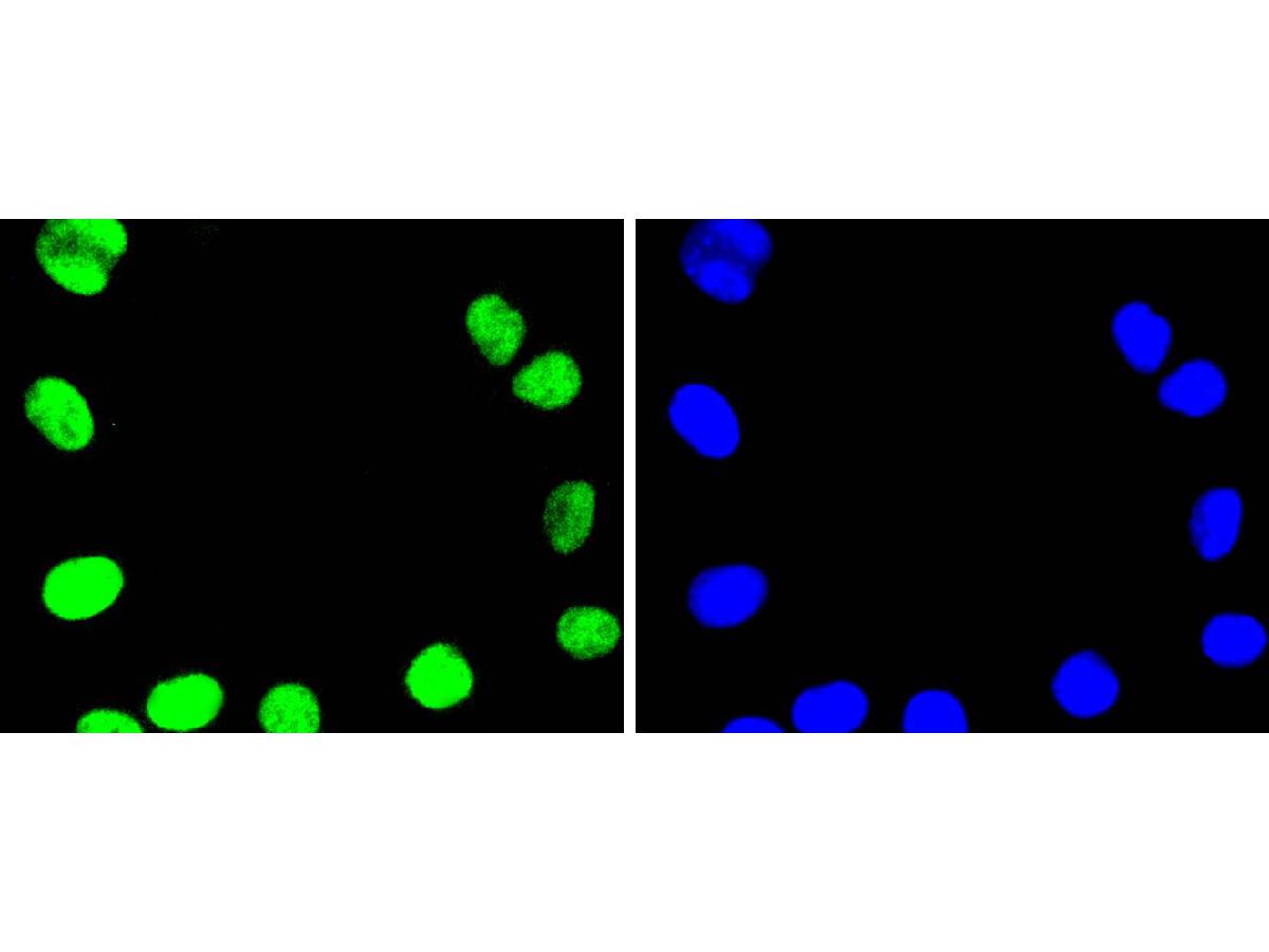 ICC staining of Topoisomerase I in 293 cells (green). Formalin fixed cells were permeabilized with 0.1% Triton X-100 in TBS for 10 minutes at room temperature and blocked with 1% Blocker BSA for 15 minutes at room temperature. Cells were probed with the primary antibody (ET1610-62, 1/50) for 1 hour at room temperature, washed with PBS. Alexa Fluor®488 Goat anti-Rabbit IgG was used as the secondary antibody at 1/1,000 dilution. The nuclear counter stain is DAPI (blue).