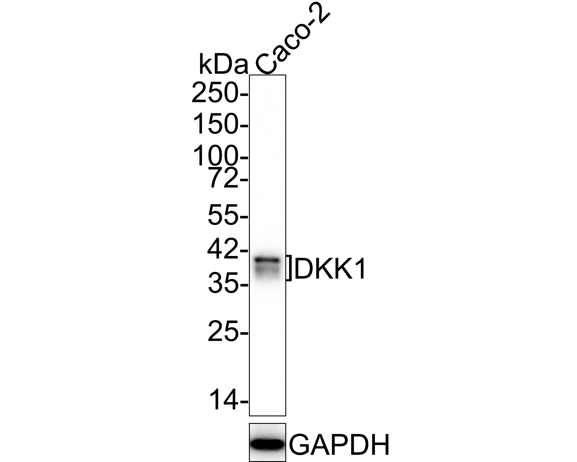 Western blot analysis of DKK1 on MCF-7 cell lysates. Proteins were transferred to a PVDF membrane and blocked with 5% BSA in PBS for 1 hour at room temperature. The primary antibody (ET1610-63, 1/500) was used in 5% BSA at room temperature for 2 hours. Goat Anti-Rabbit IgG - HRP Secondary Antibody (HA1001) at 1:5,000 dilution was used for 1 hour at room temperature.