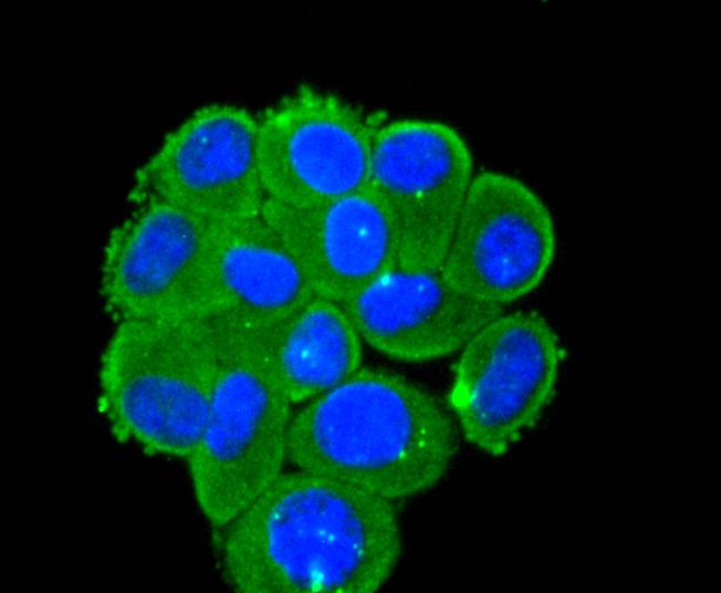 ICC staining of DKK1 in HepG2 cells (green). Formalin fixed cells were permeabilized with 0.1% Triton X-100 in TBS for 10 minutes at room temperature and blocked with 1% Blocker BSA for 15 minutes at room temperature. Cells were probed with the primary antibody (ET1610-63, 1/50) for 1 hour at room temperature, washed with PBS. Alexa Fluor®488 Goat anti-Rabbit IgG was used as the secondary antibody at 1/1,000 dilution. The nuclear counter stain is DAPI (blue).