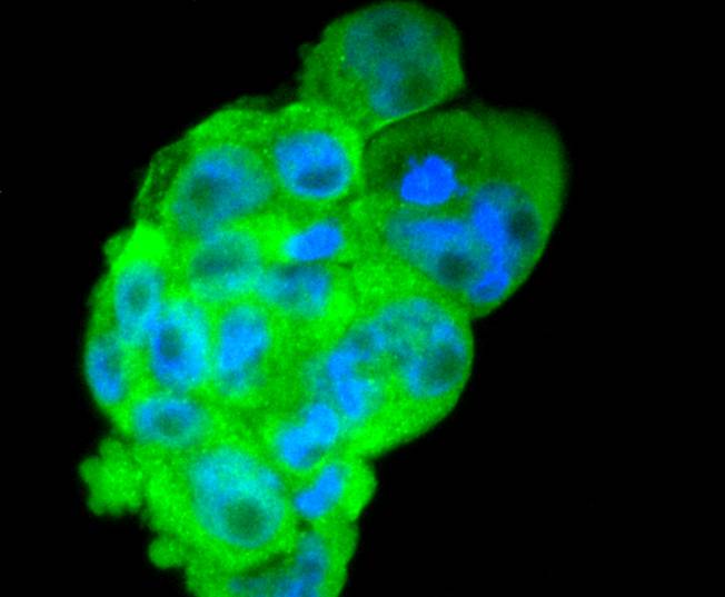 ICC staining of DKK1 in NCCIT cells (green). Formalin fixed cells were permeabilized with 0.1% Triton X-100 in TBS for 10 minutes at room temperature and blocked with 1% Blocker BSA for 15 minutes at room temperature. Cells were probed with the primary antibody (ET1610-63, 1/50) for 1 hour at room temperature, washed with PBS. Alexa Fluor®488 Goat anti-Rabbit IgG was used as the secondary antibody at 1/1,000 dilution. The nuclear counter stain is DAPI (blue).