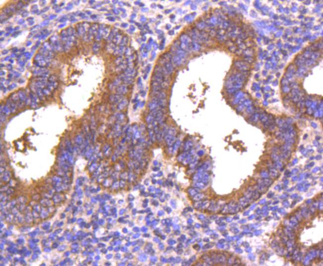 Immunohistochemical analysis of paraffin-embedded human uterus tissue using anti-DKK1 antibody. The section was pre-treated using heat mediated antigen retrieval with Tris-EDTA buffer (pH 8.0-8.4) for 20 minutes.The tissues were blocked in 5% BSA for 30 minutes at room temperature, washed with ddH2O and PBS, and then probed with the primary antibody (ET1610-63, 1/50) for 30 minutes at room temperature. The detection was performed using an HRP conjugated compact polymer system. DAB was used as the chromogen. Tissues were counterstained with hematoxylin and mounted with DPX.