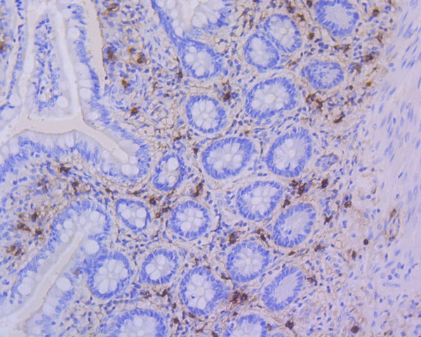 Immunohistochemical analysis of paraffin-embedded human lung tissue using anti-Mast Cell Tryptase antibody. The section was pre-treated using heat mediated antigen retrieval with Tris-EDTA buffer (pH 8.0-8.4) for 20 minutes.The tissues were blocked in 5% BSA for 30 minutes at room temperature, washed with ddH2O and PBS, and then probed with the primary antibody (ET1610-64, 1/50) for 30 minutes at room temperature. The detection was performed using an HRP conjugated compact polymer system. DAB was used as the chromogen. Tissues were counterstained with hematoxylin and mounted with DPX.