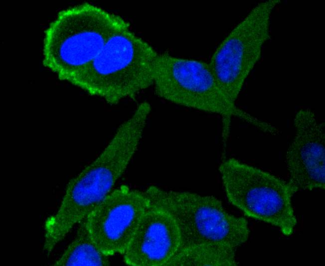 ICC staining of Moesin in Hela cells (green). Formalin fixed cells were permeabilized with 0.1% Triton X-100 in TBS for 10 minutes at room temperature and blocked with 1% Blocker BSA for 15 minutes at room temperature. Cells were probed with the primary antibody (ET1610-65, 1/50) for 1 hour at room temperature, washed with PBS. Alexa Fluor®488 Goat anti-Rabbit IgG was used as the secondary antibody at 1/1,000 dilution. The nuclear counter stain is DAPI (blue).