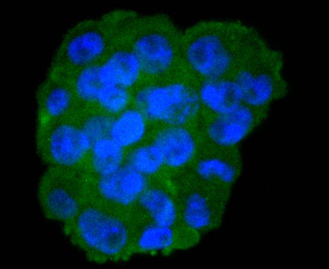ICC staining of Moesin in NCCIT cells (green). Formalin fixed cells were permeabilized with 0.1% Triton X-100 in TBS for 10 minutes at room temperature and blocked with 1% Blocker BSA for 15 minutes at room temperature. Cells were probed with the primary antibody (ET1610-65, 1/50) for 1 hour at room temperature, washed with PBS. Alexa Fluor®488 Goat anti-Rabbit IgG was used as the secondary antibody at 1/1,000 dilution. The nuclear counter stain is DAPI (blue).