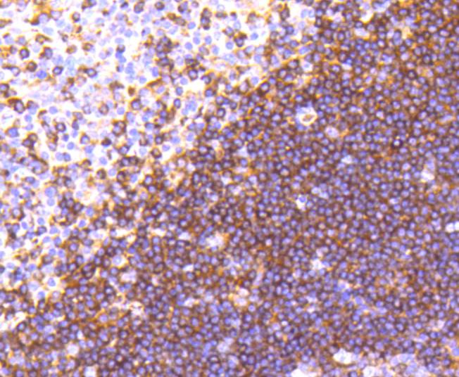 Immunohistochemical analysis of paraffin-embedded human tonsil tissue using anti-Moesin antibody. The section was pre-treated using heat mediated antigen retrieval with Tris-EDTA buffer (pH 8.0-8.4) for 20 minutes.The tissues were blocked in 5% BSA for 30 minutes at room temperature, washed with ddH2O and PBS, and then probed with the primary antibody (ET1610-65, 1/50) for 30 minutes at room temperature. The detection was performed using an HRP conjugated compact polymer system. DAB was used as the chromogen. Tissues were counterstained with hematoxylin and mounted with DPX.