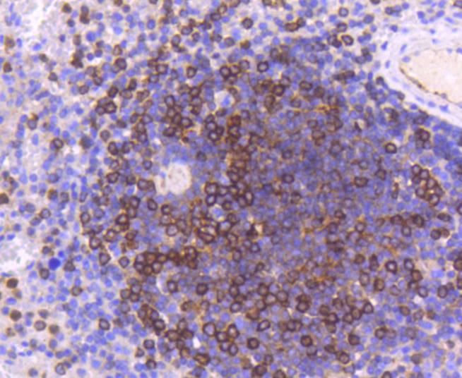 Immunohistochemical analysis of paraffin-embedded human spleen tissue using anti-Moesin antibody. The section was pre-treated using heat mediated antigen retrieval with Tris-EDTA buffer (pH 8.0-8.4) for 20 minutes.The tissues were blocked in 5% BSA for 30 minutes at room temperature, washed with ddH2O and PBS, and then probed with the primary antibody (ET1610-65, 1/50) for 30 minutes at room temperature. The detection was performed using an HRP conjugated compact polymer system. DAB was used as the chromogen. Tissues were counterstained with hematoxylin and mounted with DPX.