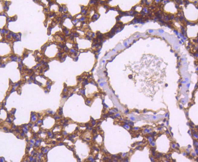 Immunohistochemical analysis of paraffin-embedded mouse lung tissue using anti-Moesin antibody. The section was pre-treated using heat mediated antigen retrieval with Tris-EDTA buffer (pH 8.0-8.4) for 20 minutes.The tissues were blocked in 5% BSA for 30 minutes at room temperature, washed with ddH2O and PBS, and then probed with the primary antibody (ET1610-65, 1/50) for 30 minutes at room temperature. The detection was performed using an HRP conjugated compact polymer system. DAB was used as the chromogen. Tissues were counterstained with hematoxylin and mounted with DPX.