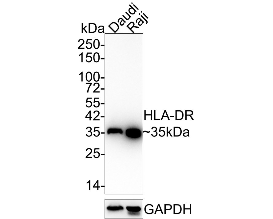 Western blot analysis of HLA-DR on Daudi cell lysates with Rabbit anti-HLA-DR antibody (ET1610-66) at 1/500 dilution.<br />
<br />
Lysates/proteins at 10 µg/Lane.<br />
<br />
Predicted band size: 29 kDa<br />
Observed band size: 35 kDa<br />
<br />
Exposure time: 2 minutes;<br />
<br />
12% SDS-PAGE gel.<br />
<br />
Proteins were transferred to a PVDF membrane and blocked with 5% NFDM/TBST for 1 hour at room temperature. The primary antibody (ET1610-66) at 1/500 dilution was used in 5% NFDM/TBST at room temperature for 2 hours. Goat Anti-Rabbit IgG - HRP Secondary Antibody (HA1001) at 1:300,000 dilution was used for 1 hour at room temperature.