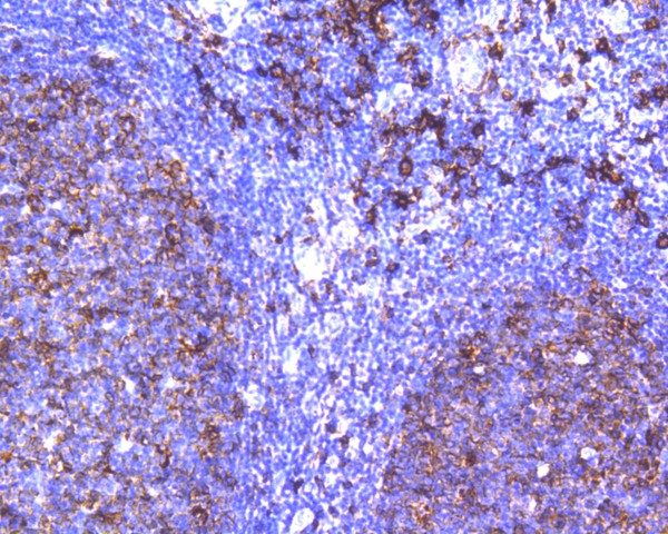 Immunohistochemical analysis of paraffin-embedded human tonsil tissue using anti-HLA-DR antibody. The section was pre-treated using heat mediated antigen retrieval with Tris-EDTA buffer (pH 9.0) for 20 minutes.The tissues were blocked in 5% BSA for 30 minutes at room temperature, washed with ddH2O and PBS, and then probed with the primary antibody (ET1610-66, 1/200) for 30 minutes at room temperature. The detection was performed using an HRP conjugated compact polymer system. DAB was used as the chromogen. Tissues were counterstained with hematoxylin and mounted with DPX.
