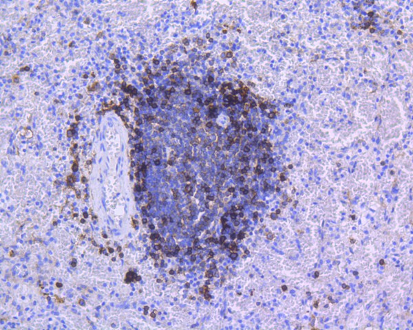 Immunohistochemical analysis of paraffin-embedded human spleen tissue using anti-HLA-DR antibody. The section was pre-treated using heat mediated antigen retrieval with Tris-EDTA buffer (pH 9.0) for 20 minutes.The tissues were blocked in 5% BSA for 30 minutes at room temperature, washed with ddH2O and PBS, and then probed with the primary antibody (ET1610-66, 1/200) for 30 minutes at room temperature. The detection was performed using an HRP conjugated compact polymer system. DAB was used as the chromogen. Tissues were counterstained with hematoxylin and mounted with DPX.