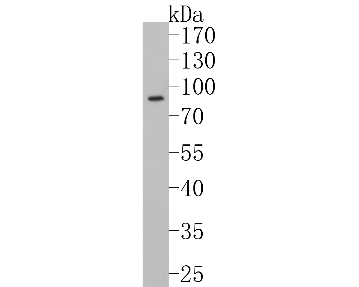 Western blot analysis of GARS on Raji cell lysates. Proteins were transferred to a PVDF membrane and blocked with 5% BSA in PBS for 1 hour at room temperature. The primary antibody (ET1610-67, 1/500) was used in 5% BSA at room temperature for 2 hours. Goat Anti-Rabbit IgG - HRP Secondary Antibody (HA1001) at 1:40,000 dilution was used for 1 hour at room temperature.