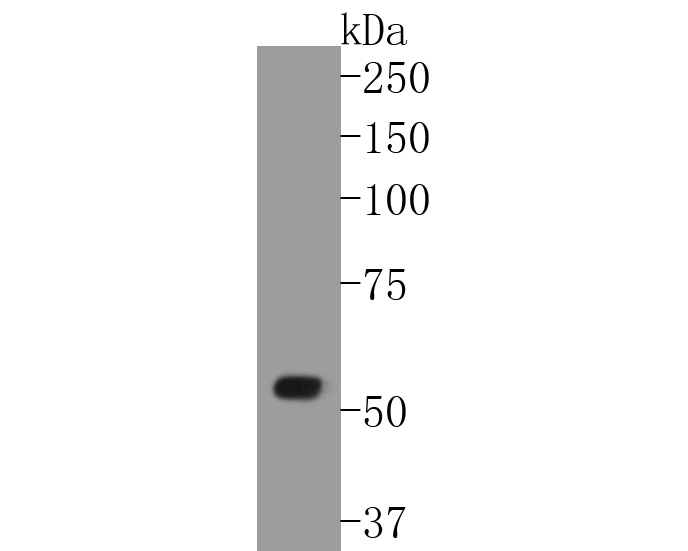 Western blot analysis of WASF2 on human placenta tissue lysates. Proteins were transferred to a PVDF membrane and blocked with 5% BSA in PBS for 1 hour at room temperature. The primary antibody (ET1610-69, 1/500) was used in 5% BSA at room temperature for 2 hours. Goat Anti-Rabbit IgG - HRP Secondary Antibody (HA1001) at 1:5,000 dilution was used for 1 hour at room temperature.