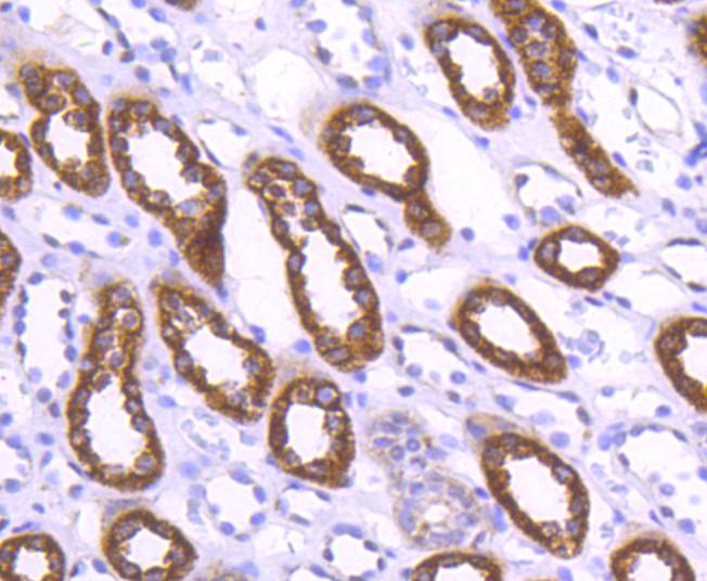 Immunohistochemical analysis of paraffin-embedded human kidney tissue using anti-WASF2 antibody. The section was pre-treated using heat mediated antigen retrieval with Tris-EDTA buffer (pH 8.0-8.4) for 20 minutes.The tissues were blocked in 5% BSA for 30 minutes at room temperature, washed with ddH2O and PBS, and then probed with the primary antibody (ET1610-69, 1/50) for 30 minutes at room temperature. The detection was performed using an HRP conjugated compact polymer system. DAB was used as the chromogen. Tissues were counterstained with hematoxylin and mounted with DPX.