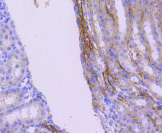 Immunohistochemical analysis of paraffin-embedded mouse kidney tissue using anti-WASF2 antibody. The section was pre-treated using heat mediated antigen retrieval with Tris-EDTA buffer (pH 8.0-8.4) for 20 minutes.The tissues were blocked in 5% BSA for 30 minutes at room temperature, washed with ddH2O and PBS, and then probed with the primary antibody (ET1610-69, 1/50) for 30 minutes at room temperature. The detection was performed using an HRP conjugated compact polymer system. DAB was used as the chromogen. Tissues were counterstained with hematoxylin and mounted with DPX.