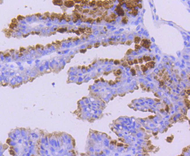 Immunohistochemical analysis of paraffin-embedded mouse placenta tissue using anti-WASF2 antibody. The section was pre-treated using heat mediated antigen retrieval with Tris-EDTA buffer (pH 8.0-8.4) for 20 minutes.The tissues were blocked in 5% BSA for 30 minutes at room temperature, washed with ddH2O and PBS, and then probed with the primary antibody (ET1610-69, 1/50) for 30 minutes at room temperature. The detection was performed using an HRP conjugated compact polymer system. DAB was used as the chromogen. Tissues were counterstained with hematoxylin and mounted with DPX.