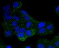 ICC staining Daxx in Hela cells (green). The nuclear counter stain is DAPI (blue). Cells were fixed in paraformaldehyde, permeabilised with 0.25% Triton X100/PBS.