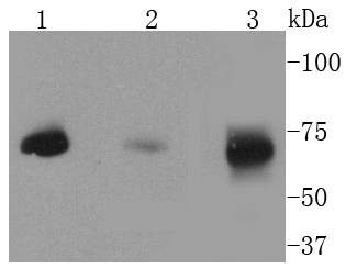 Western blot analysis of MEKK2 on different lysates using anti-MEKK2 antibody at 1/1,000 dilution.<br />
Positive control:   <br />
Lane 1: HepG2            <br />
Lane 2: Rat brain <br />
Lane 3: SW480