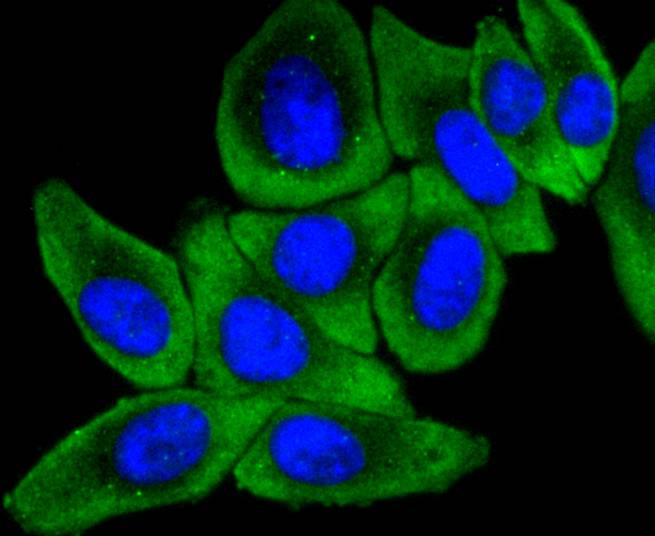 ICC staining MEKK2 in HepG2 cells (green). The nuclear counter stain is DAPI (blue). Cells were fixed in paraformaldehyde, permeabilised with 0.25% Triton X100/PBS.