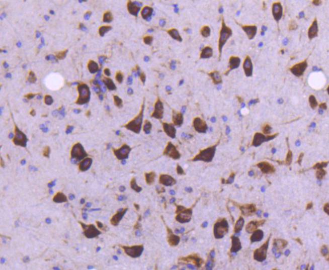Immunohistochemical analysis of paraffin-embedded mouse brain tissue using anti-MEKK2 antibody. Counter stained with hematoxylin.