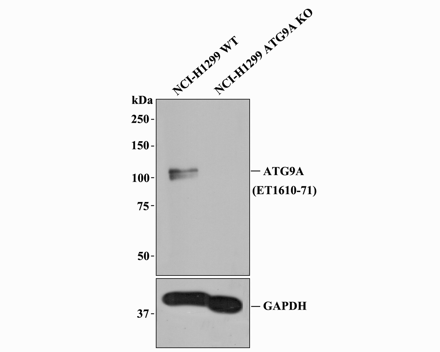 All lanes: Western blot analysis of ATG9A with anti-ATG9A antibody [SC67-05] (ET1610-71) at 1:1,000 dilution.<br />
Lane 1: Wild-type NCI-H1299 whole cell lysate (20 µg).<br />
Lane 2: ATG9A knockout NCI-H1299 whole cell lysate (20 µg).<br />
<br />
ET1610-71 was shown to specifically react with ATG9A in wild-type NCI-H1299 cells. No band was observed when ATG9A knockout sample was tested. Wild-type and ATG9A knockout samples were subjected to SDS-PAGE. Proteins were transferred to a PVDF membrane and blocked with 5% NFDM in TBST for 1 hour at room temperature. The primary antibody (ET1610-71, 1/1,000) and Loading control antibody (Rabbit anti-GAPDH , ET1601-4, 1/10,000) was used in 5% BSA at room temperature for 2 hours. Goat Anti-Rabbit IgG-HRP Secondary Antibody (HA1001) at 1:200,000 dilution was used for 1 hour at room temperature.