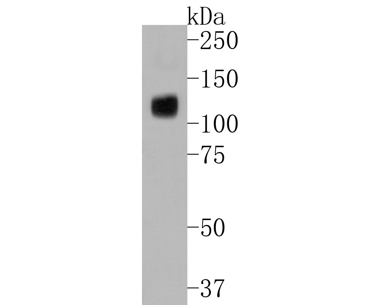 Western blot analysis of ATG9A on HepG2 cell lysates. Proteins were transferred to a PVDF membrane and blocked with 5% BSA in PBS for 1 hour at room temperature. The primary antibody (ET1610-71, 1/500) was used in 5% BSA at room temperature for 2 hours. Goat Anti-Rabbit IgG - HRP Secondary Antibody (HA1001) at 1:5,000 dilution was used for 1 hour at room temperature.
