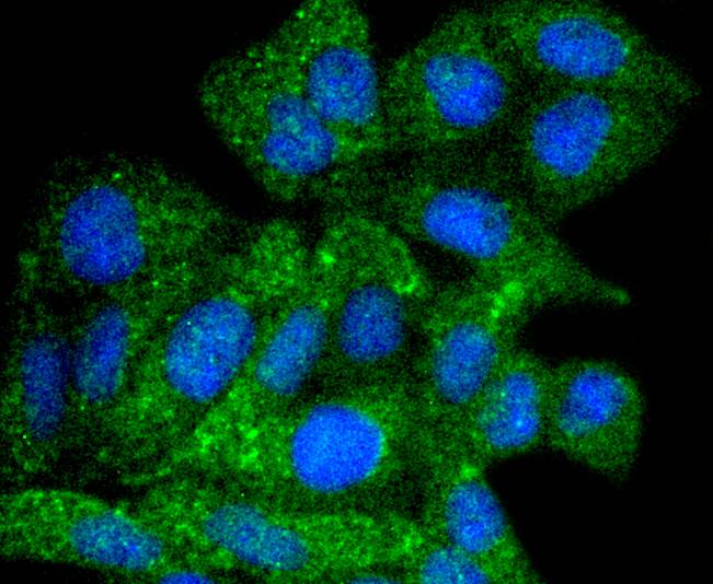 ICC staining of ATG9A in Hela cells (green). Formalin fixed cells were permeabilized with 0.1% Triton X-100 in TBS for 10 minutes at room temperature and blocked with 1% Blocker BSA for 15 minutes at room temperature. Cells were probed with the primary antibody (ET1610-71, 1/50) for 1 hour at room temperature, washed with PBS. Alexa Fluor®488 Goat anti-Rabbit IgG was used as the secondary antibody at 1/1,000 dilution. The nuclear counter stain is DAPI (blue).