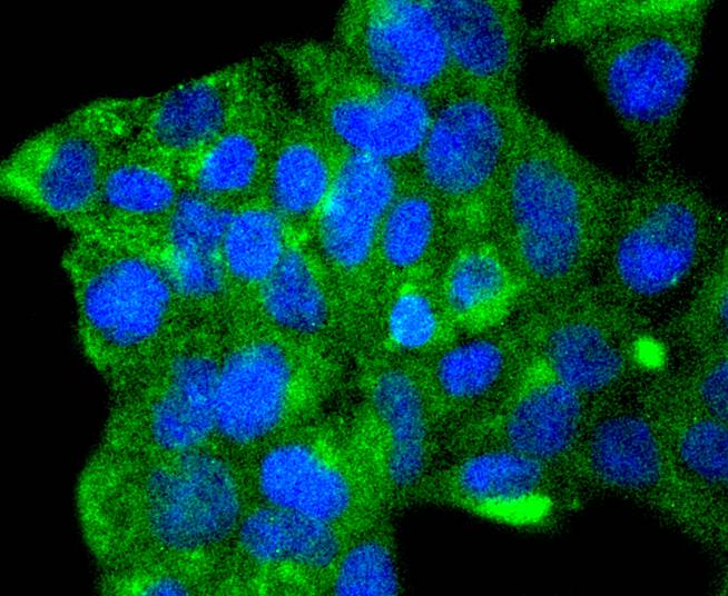 ICC staining of ATG9A in 293 cells (green). Formalin fixed cells were permeabilized with 0.1% Triton X-100 in TBS for 10 minutes at room temperature and blocked with 1% Blocker BSA for 15 minutes at room temperature. Cells were probed with the primary antibody (ET1610-71, 1/50) for 1 hour at room temperature, washed with PBS. Alexa Fluor®488 Goat anti-Rabbit IgG was used as the secondary antibody at 1/1,000 dilution. The nuclear counter stain is DAPI (blue).