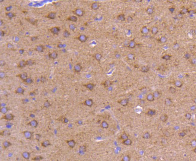 Immunohistochemical analysis of paraffin-embedded rat brain tissue using anti-ATG9A antibody. The section was pre-treated using heat mediated antigen retrieval with Tris-EDTA buffer (pH 8.0-8.4) for 20 minutes.The tissues were blocked in 5% BSA for 30 minutes at room temperature, washed with ddH2O and PBS, and then probed with the primary antibody (ET1610-71, 1/50) for 30 minutes at room temperature. The detection was performed using an HRP conjugated compact polymer system. DAB was used as the chromogen. Tissues were counterstained with hematoxylin and mounted with DPX.