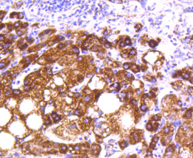 Immunohistochemical analysis of paraffin-embedded human liver tissue using anti-MTCO2 antibody. The section was pre-treated using heat mediated antigen retrieval with Tris-EDTA buffer (pH 8.0-8.4) for 20 minutes.The tissues were blocked in 5% BSA for 30 minutes at room temperature, washed with ddH2O and PBS, and then probed with the primary antibody (ET1610-72, 1/50) for 30 minutes at room temperature. The detection was performed using an HRP conjugated compact polymer system. DAB was used as the chromogen. Tissues were counterstained with hematoxylin and mounted with DPX.
