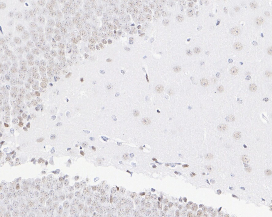 ICC staining of TCF7L2 in D3 cells (green). Formalin fixed cells were permeabilized with 0.1% Triton X-100 in TBS for 10 minutes at room temperature and blocked with 1% Blocker BSA for 15 minutes at room temperature. Cells were probed with the primary antibody (ET1610-73, 1/50) for 1 hour at room temperature, washed with PBS. Alexa Fluor®488 Goat anti-Rabbit IgG was used as the secondary antibody at 1/1,000 dilution. The nuclear counter stain is DAPI (blue).