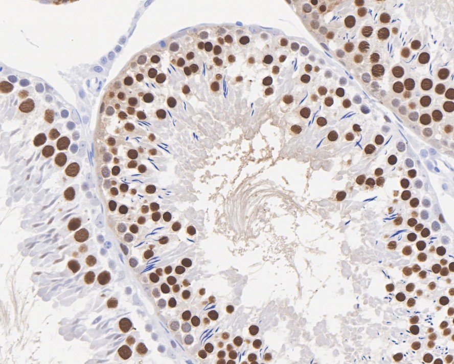 Immunohistochemical analysis of paraffin-embedded human kidney tissue using anti-TCF7L2 antibody. The section was pre-treated using heat mediated antigen retrieval with Tris-EDTA buffer (pH 8.0-8.4) for 20 minutes.The tissues were blocked in 5% BSA for 30 minutes at room temperature, washed with ddH2O and PBS, and then probed with the primary antibody (ET1610-73, 1/50) for 30 minutes at room temperature. The detection was performed using an HRP conjugated compact polymer system. DAB was used as the chromogen. Tissues were counterstained with hematoxylin and mounted with DPX.