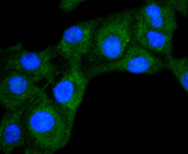ICC staining DIABLO in B16-F1 cells (green). The nuclear counter stain is DAPI (blue). Cells were fixed in paraformaldehyde, permeabilised with 0.25% Triton X100/PBS.